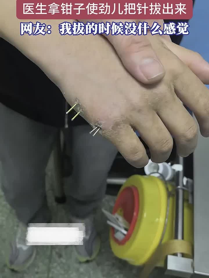 煉鍼(炼铁的化学方程式)